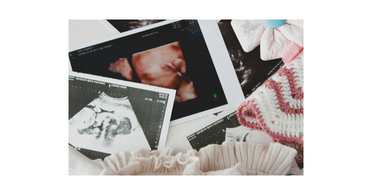 Several ultrasound images of a foetus displayed next to baby clothing.